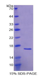 激活素A受體Ⅰ(ACVR1)重組蛋白,Recombinant Activin A Receptor Type I (ACVR1)