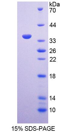 基质重塑关联蛋白5(MXRA5)重组蛋白,Recombinant Matrix Remodelling Associated Protein 5 (MXRA5)