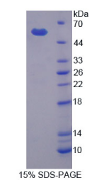 基质金属蛋白酶3(MMP3)重组蛋白,Recombinant Matrix Metalloproteinase 3 (MMP3)