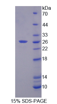 基質(zhì)金屬蛋白酶21(MMP21)重組蛋白,Recombinant Matrix Metalloproteinase 21 (MMP21)