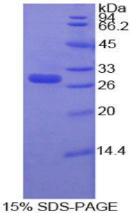 基質(zhì)金屬蛋白酶16(MMP16)重組蛋白,Recombinant Matrix Metalloproteinase 16 (MMP16)