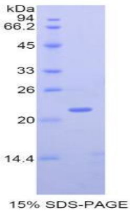 基质金属蛋白酶12(MMP12)重组蛋白,Recombinant Matrix Metalloproteinase 12 (MMP12)