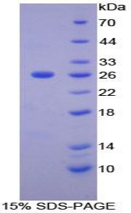 基质金属蛋白酶11(MMP11)重组蛋白,Recombinant Matrix Metalloproteinase 11 (MMP11)