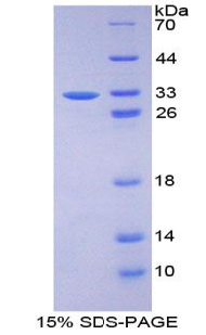 肌原纤蛋白3(FBN3)重组蛋白,Recombinant Fibrillin 3 (FBN3)