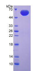 肌原纖蛋白2(FBN2)重組蛋白,Recombinant Fibrillin 2 (FBN2)