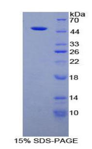 肌原纖蛋白1(FBN1)重組蛋白,Recombinant Fibrillin 1 (FBN1)