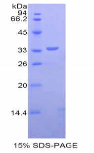 肌营养不良蛋白(DMD)重组蛋白,Recombinant Dystrophin (DMD)