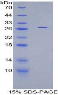 肌纤蛋白(MYOC)重组蛋白,Recombinant Myocilin (MYOC)