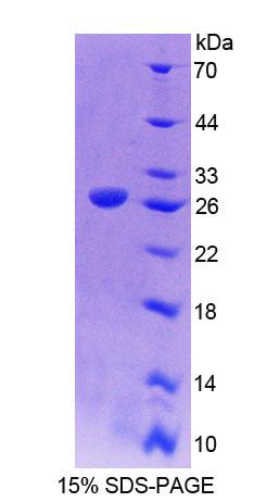 肌微管钙黏附蛋白(CDH15)重组蛋白,Recombinant Cadherin, Myotubule (CDH15)