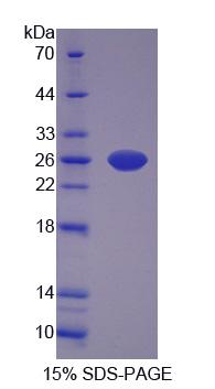 肌肽合酶1(CARNS1)重组蛋白,Recombinant Carnosine Synthase 1 (CARNS1)