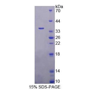 甲基CpG结合域蛋白2(MBD2)重组蛋白