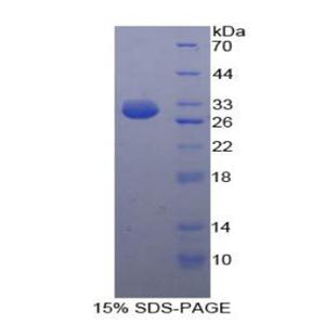 己糖激酶3(HK3)重组蛋白