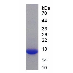 己糖激酶1(HK1)重组蛋白,Recombinant Hexokinase 1 (HK1)