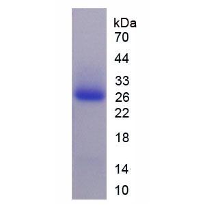 集聚蛋白(AGRN)重组蛋白,Recombinant Agrin (AGRN)