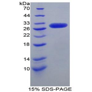 激肽原1(KNG1)重组蛋白