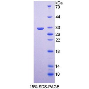 激肽释放酶9(KLK9)重组蛋白,Recombinant Kallikrein 9 (KLK9)