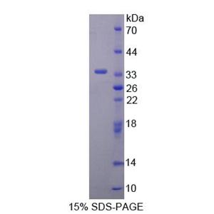 激肽释放酶8(KLK8)重组蛋白