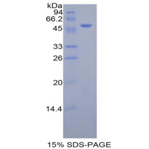 激肽释放酶7(KLK7)重组蛋白
