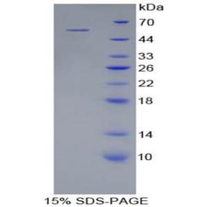 激肽释放酶6(KLK6)重组蛋白,Recombinant Kallikrein 6 (KLK6)