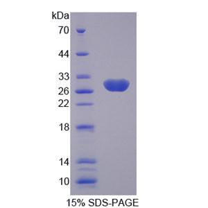 激肽释放酶4(KLK4)重组蛋白