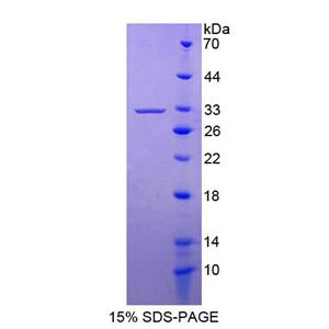 激肽釋放酶13(KLK13)重組蛋白,Recombinant Kallikrein 14 (KLK14)