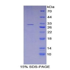 激肽释放酶11(KLK11)重组蛋白