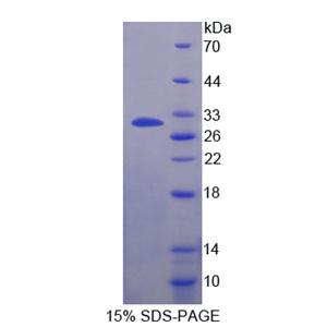 激肽释放酶10(KLK10)重组蛋白
