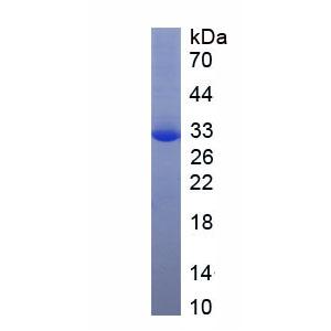 激肽释放酶1(KLK1)重组蛋白