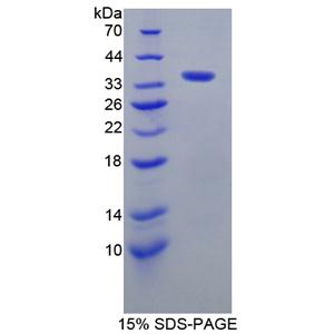 激酶錨定蛋白11(AKAP11)重組蛋白,Recombinant A Kinase Anchor Protein 11 (AKAP11)