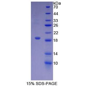 激活素A受体ⅡA(ACVR2A)重组蛋白,Recombinant Activin A Receptor Type II A (ACVR2A)