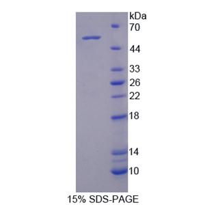 激活素A受体ⅠC(ACVR1C)重组蛋白,Recombinant Activin A Receptor Type I C (ACVR1C)