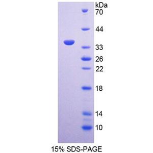 基质重塑关联蛋白5(MXRA5)重组蛋白,Recombinant Matrix Remodelling Associated Protein 5 (MXRA5)