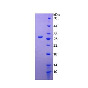 基質(zhì)金屬蛋白酶14(MMP14)重組蛋白,Recombinant Matrix Metalloproteinase 14 (MMP14)