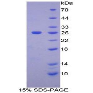 基质金属蛋白酶11(MMP11)重组蛋白,Recombinant Matrix Metalloproteinase 11 (MMP11)