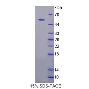 基质金属蛋白酶1(MMP1)重组蛋白,Recombinant Matrix Metalloproteinase 1 (MMP1)