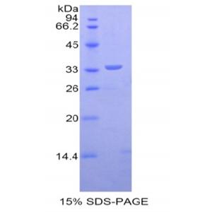 肌营养不良蛋白(DMD)重组蛋白