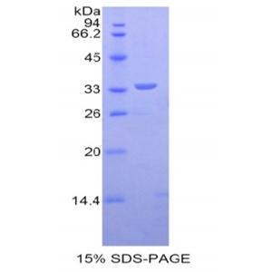 肌营养不良蛋白(DMD)重组蛋白,Recombinant Dystrophin (DMD)