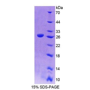 肌微管钙黏附蛋白(CDH15)重组蛋白