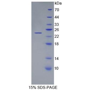 肌肽酶1(CNDP1)重组蛋白,Recombinant Carnosine Dipeptidase 1 (CNDP1)