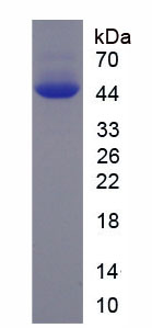 肌肉磷酸果糖激酶(PFKM)重组蛋白,Recombinant Phosphofructokinase, Muscle (PFKM)