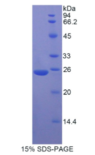 肌球蛋白重链8(MYH8)重组蛋白,Recombinant Myosin Heavy Chain 8, Skeletal Muscle, Perinatal (MYH8)