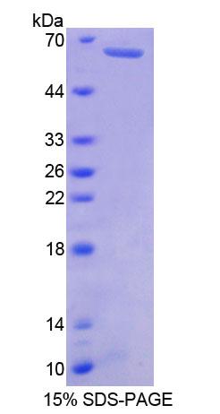 肌球蛋白重链7B(MYH7B)重组蛋白,Recombinant Myosin Heavy Chain 7B, Cardiac Muscle Beta (MYH7B)