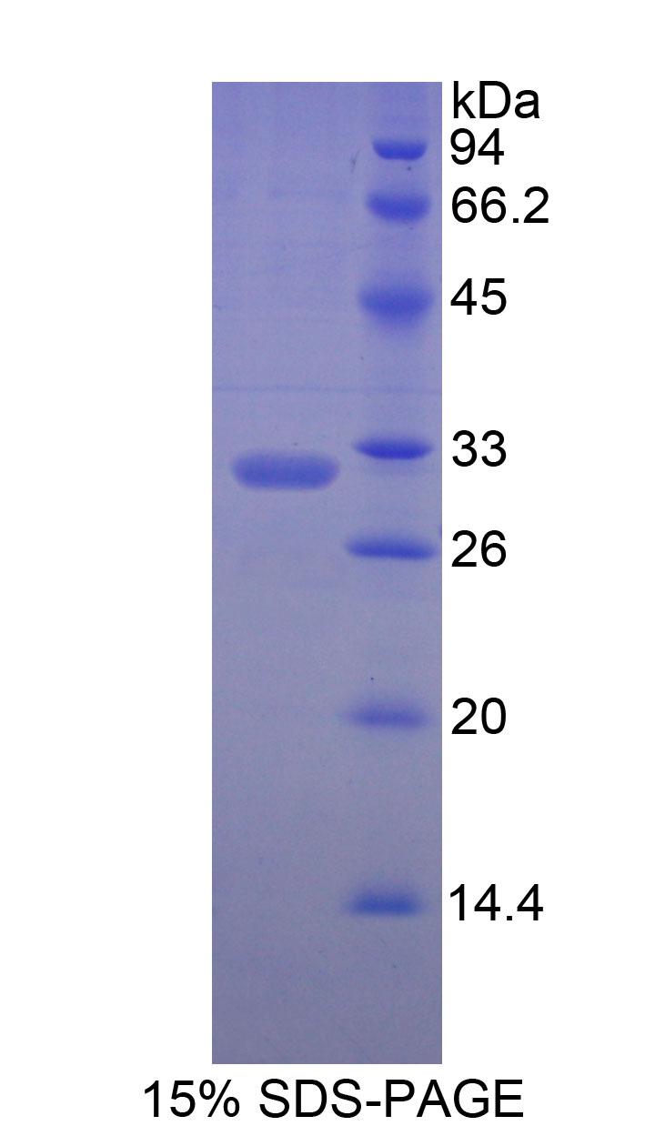 肌球蛋白重鏈7(MYH7)重組蛋白,Recombinant Myosin Heavy Chain 7, Cardiac Muscle, Beta (MYH7)