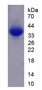 肌球蛋白重鏈6(MYH6)重組蛋白,Recombinant Myosin Heavy Chain 6, Cardiac Muscle, Alpha (MYH6)