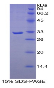 肌球蛋白重链16(MYH16)重组蛋白,Recombinant Myosin Heavy Chain 16 (MYH16)