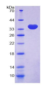 肌球蛋白重链10(MYH10)重组蛋白,Recombinant Myosin Heavy Chain 10, Non Muscle (MYH10)