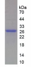 肌球蛋白重链1(MYH1)重组蛋白,Recombinant Myosin Heavy Chain 1 (MYH1)