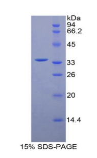 肌球蛋白輕鏈激酶4(MYLK4)重組蛋白,Recombinant Myosin Light Chain Kinase 4 (MYLK4)