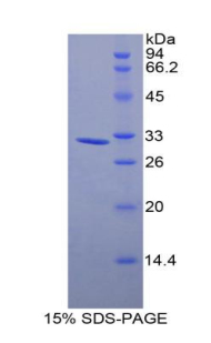 肌球蛋白輕鏈激酶3(MYLK3)重組蛋白,Recombinant Myosin Light Chain Kinase 3 (MYLK3)