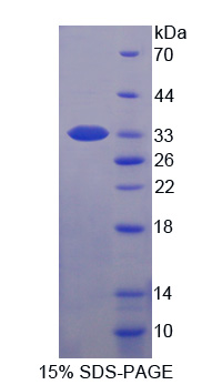 肌球蛋白轻链激酶2(MYLK2)重组蛋白,Recombinant Myosin Light Chain Kinase 2 (MYLK2)